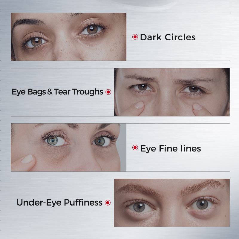 Koyu Halkalar için Göz Bantlar - Eye Pad Collagen incelemesi ve fiyatı
